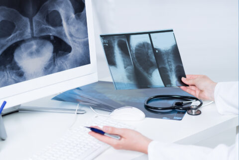 Nasce la figura del Bone Doctor, lo specialista per le ossa fragili
