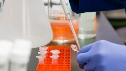 Ipofosfatemia legata all’X: una giornata per ricordarla